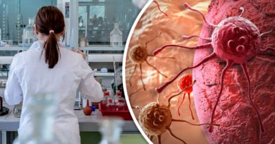 Descubren tratamiento para combatir la metástasis