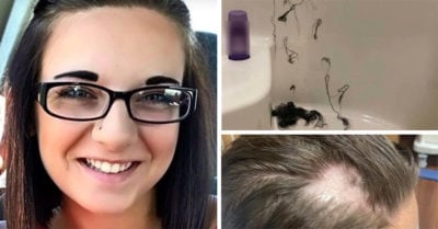 Mujer se queda calva por usar acondicionador que había sido mezclado con crema depilatoria