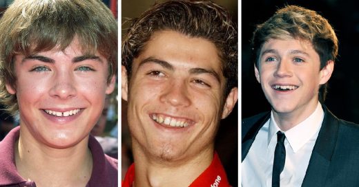 20 Pruebas de que los brackets son una maravilla estética