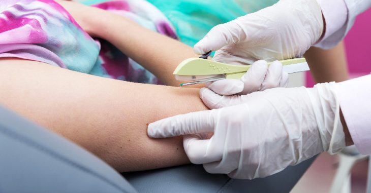 Implante anticonceptivo: ventajas, desventajas y efectividad