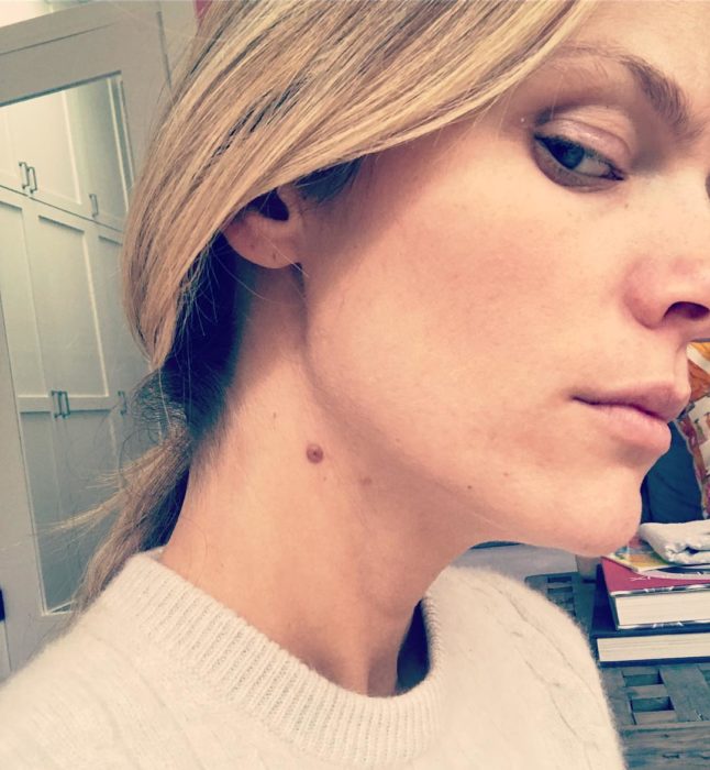 Foto de Brooklyn Decker mostrando un lunar en su cuello