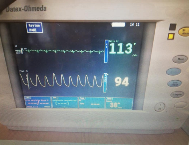 Historia de amor con final triste; chico cuenta cómo fue la vida con su novia; monitor de latidos del corazón