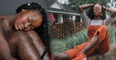 Rompe los estereotipos del modelaje al mostrar su piel al natural