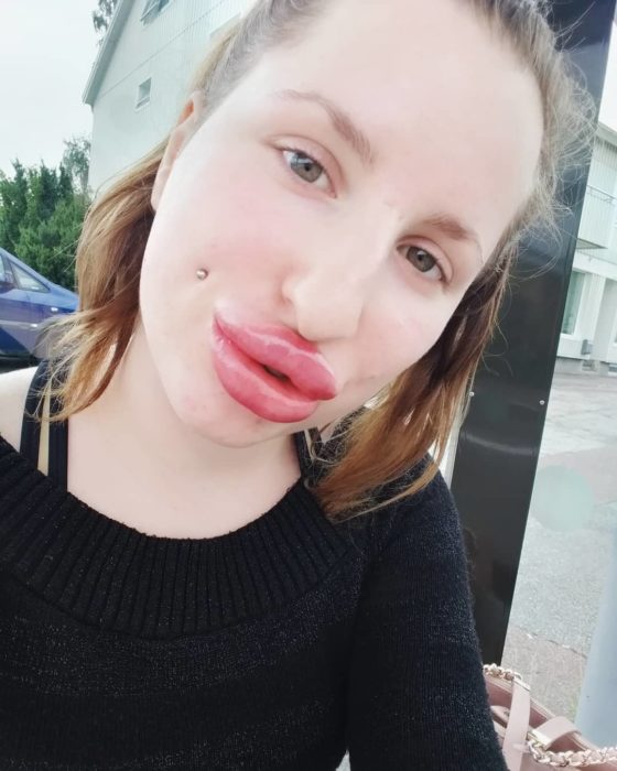 De las fotos más recientes de Tamara Tullum con sus labios más agrandados por los rellenos