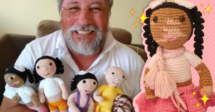 Un hombre brasileño crea Vitilinda, la muñeca con vitiligo que busca romper prejuicios