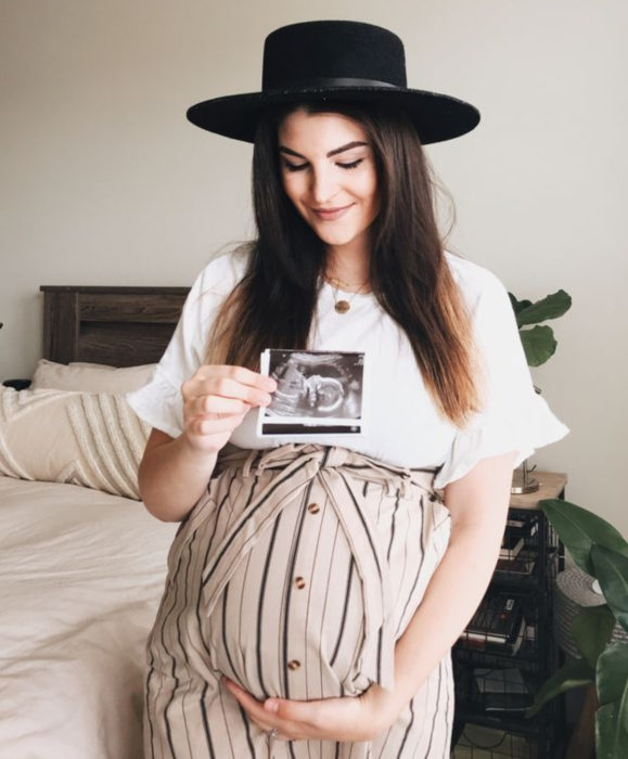 Razones por las que las axilas se oscurecen; chica de cabello castaño y largo con sombrero de copa negro; embarazada sosteniendo foto de ecografía de su bebé