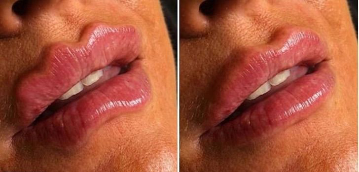 Chica mostrando el antes y después de sus labios endemoniados 