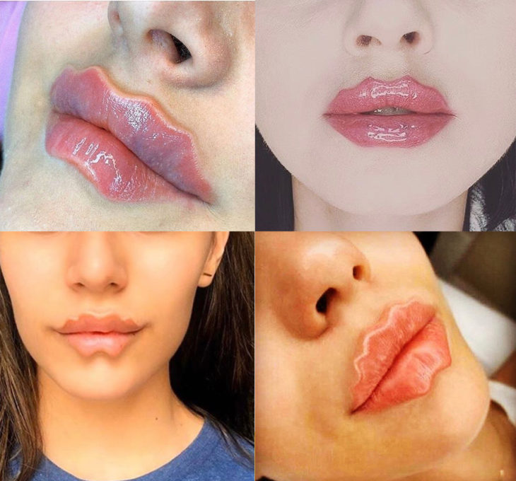 Mujeres mostrando sus devil lips modificados 