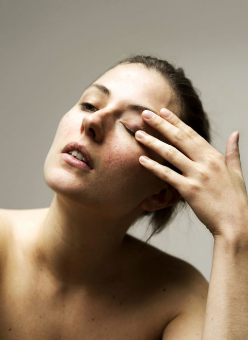 Retrato de mujer con piel del rostro irritada