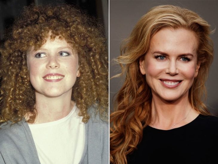 Nicole Kidman antes y después