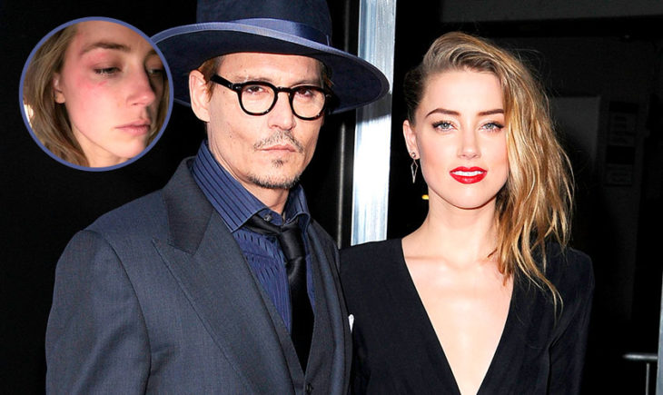 Amber Heard acusa Johnny Depp de violencia domestica y muestra marcas