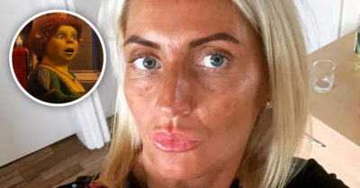 Trata de autobroncearse, falla en el intento y termina verde como Fiona