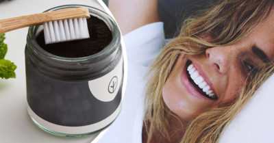 8 Trucos para decirle adiós al sarro dental desde tu casa