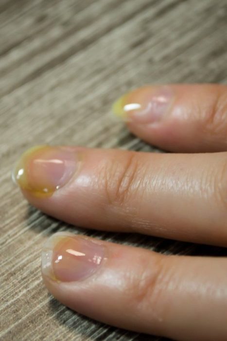 Uñas con aceite de oliva y aceite de árbol de té