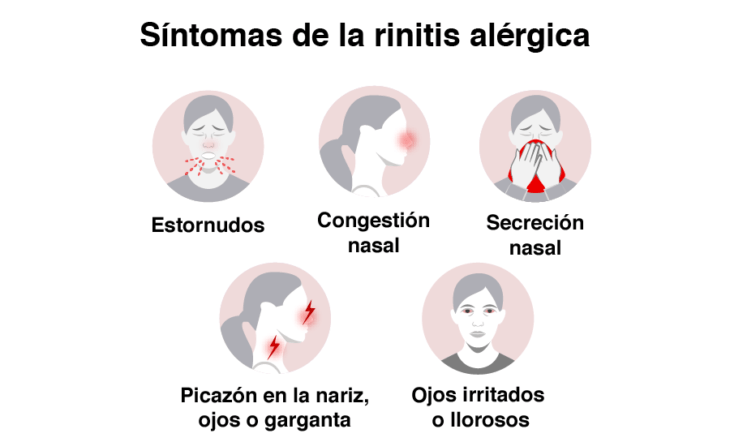 Infografía sobre los síntomas de la alergia 