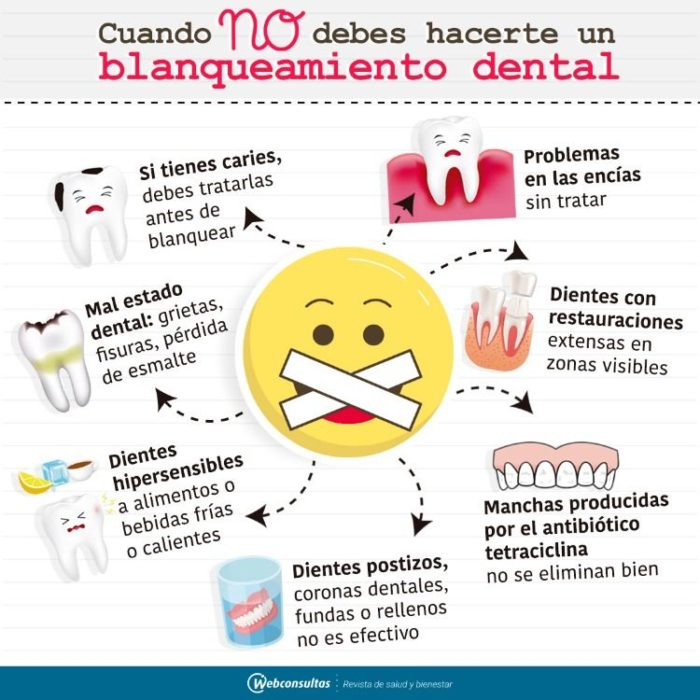 Infografía sobre cuando no debes de realizar un blanqueamiento dental