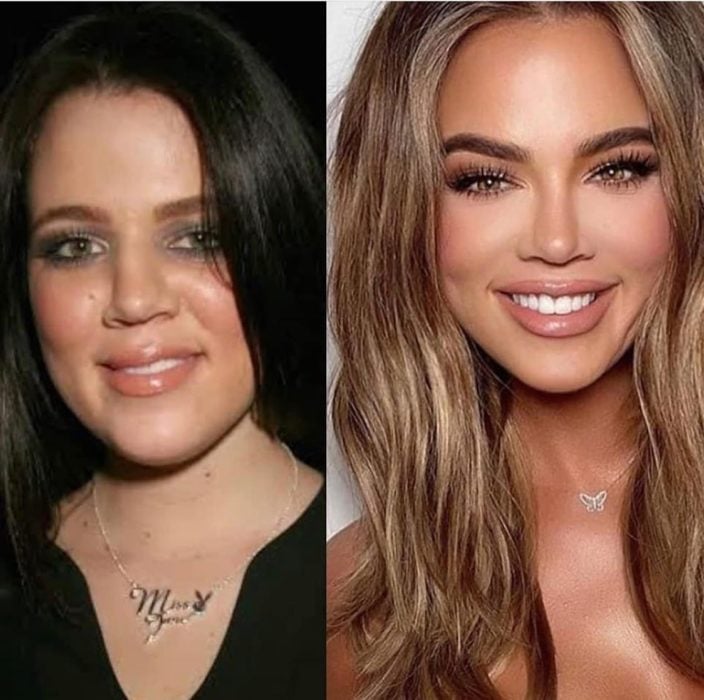 Khloe Kardashian antes y después