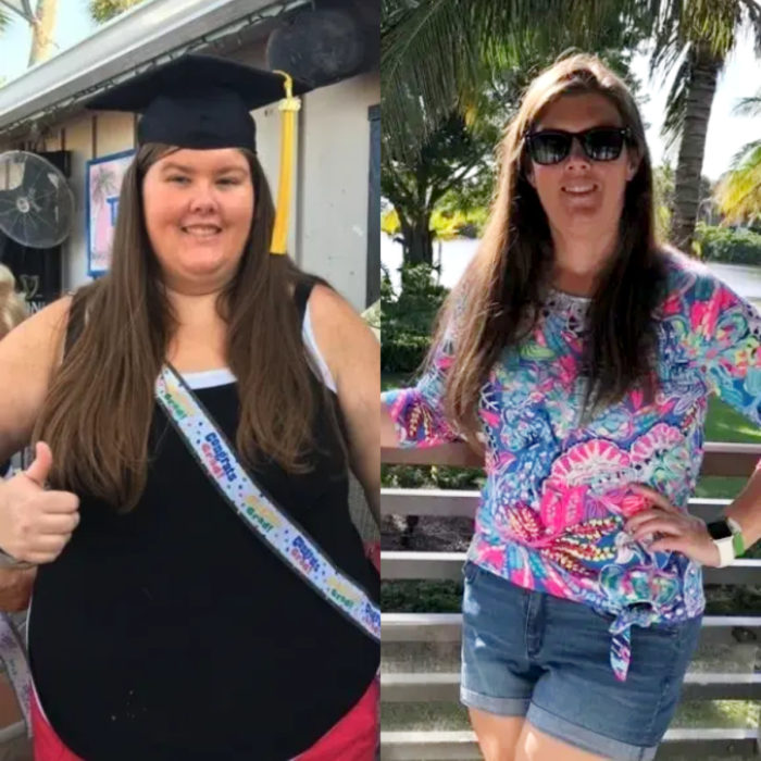 Mujer antes y después de bajar de peso