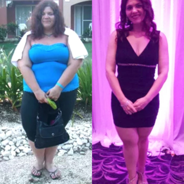 Mujer antes y después de bajar de peso