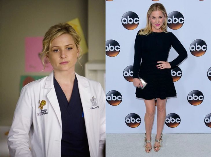 Antes y después de Arizona Robbins