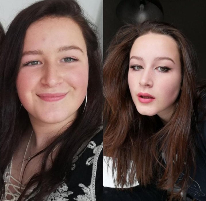 Chica antes y después de bajar de peso