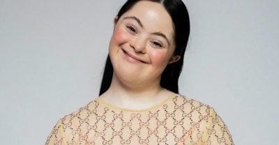 Modelo con síndrome de Down se convierte en la nueva imagen de Gucci Beauty