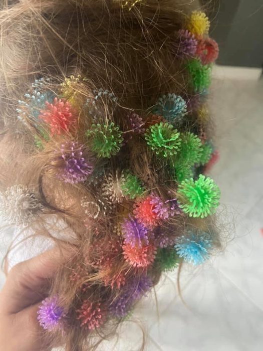 Niña se enreda el cabello con gomas de juguete