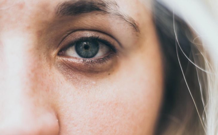 Chica de tez clara y ojos azules con ojeras pronunciadas