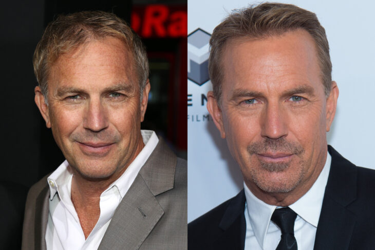 Kevin Costner antes y después del injerto de cabello