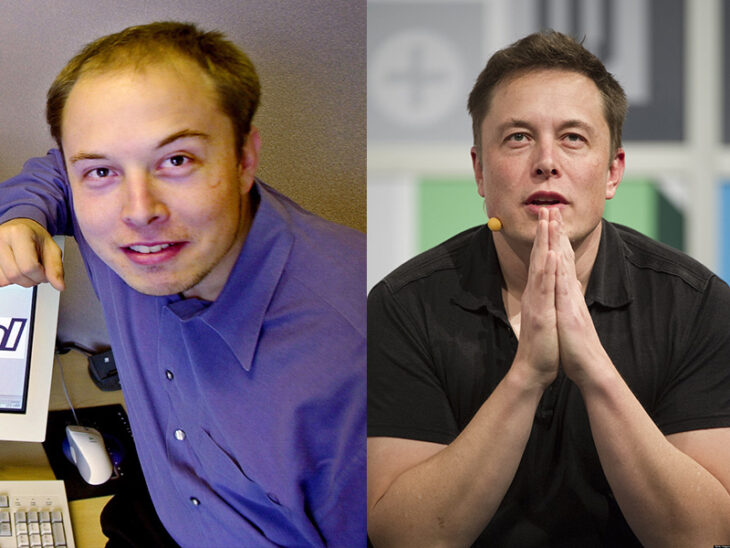 Elon Musk antes y después del injerto de cabello