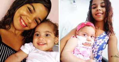 Joven de 18 años adopta a bebé con parálisis cerebral que sufría maltrato