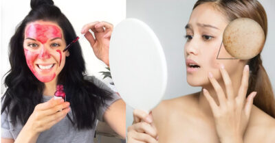 Ácido glicólico: el secreto para una piel sin imperfecciones