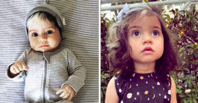 Adorable bebé nace con canas debido a una extraña condición genética