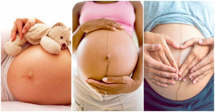 Mujeres embarazadas mostrando la línea alba de su vientre