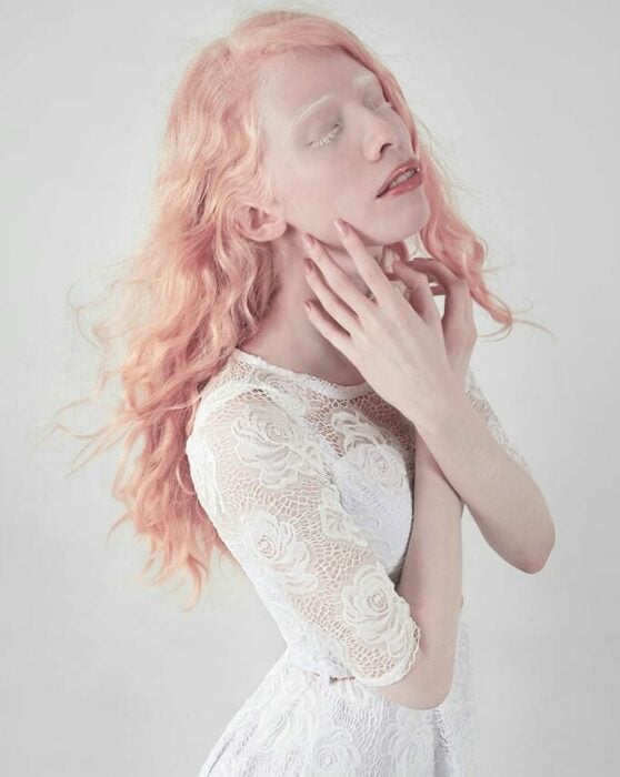 Ruby vizcarra, modelo albina mexicana posando para una foto mientras usaba un vestido blanco 