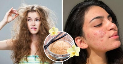 6 Beneficios que la vainilla puede aportar a tu piel y cabello