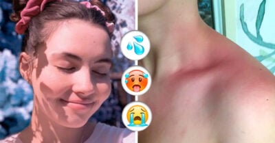 Tessa Hansen-Smith, la chica con alergia al agua, llorar o incluso sudar