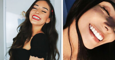Diseño de sonrisa, el procedimiento dental que las celebridades están amando