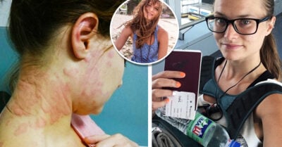 Se volvió alérgica al trabajo bajo estrés y ahora viaja por el mundo para sanarse