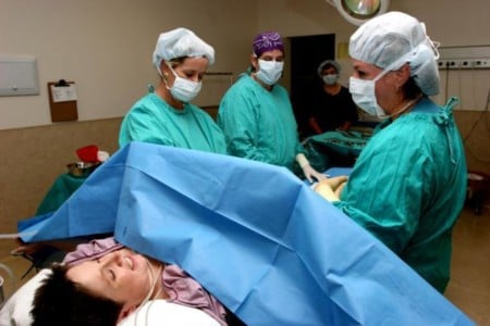 Doctores y enfermeras juntas en una cirugía de cesárea 