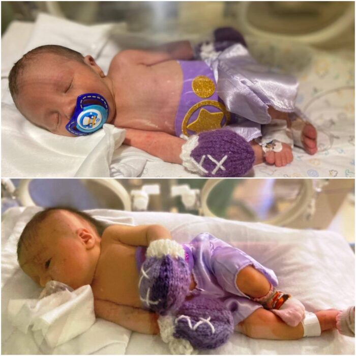 Babies dressed as boxers;  Hospital dresses premature babies as boxers because they are life warriors