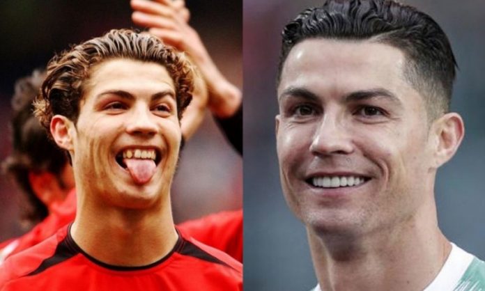 Cristiano Ronaldo; 13 Famosos que le deben su hermosa sonrisa al dentista
