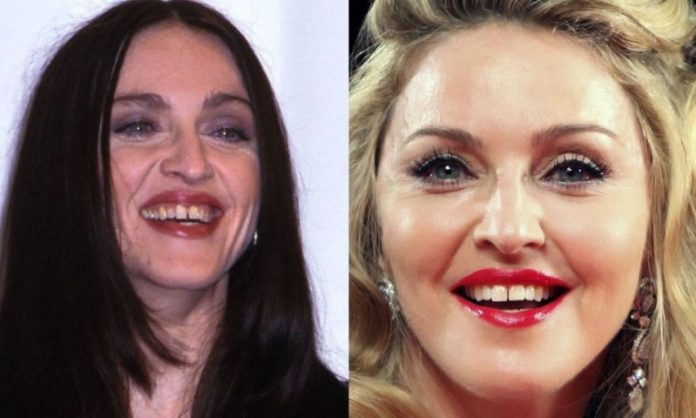 Madonna; 13 Famosos que le deben su hermosa sonrisa al dentista