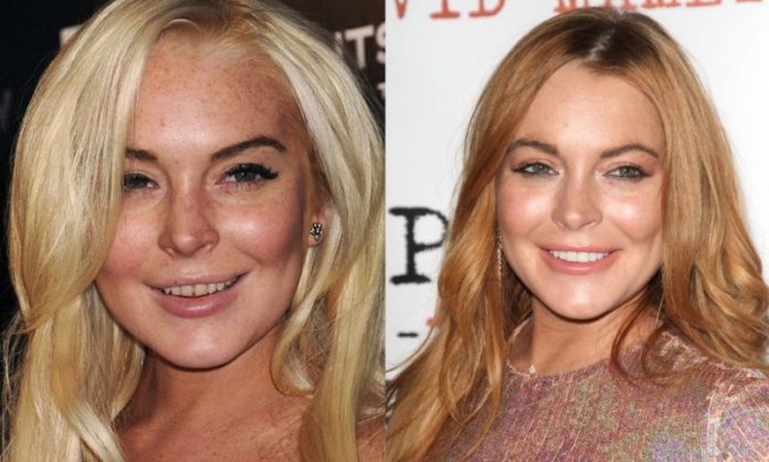Lindsay Lohan; 13 Famosos que le deben su hermosa sonrisa al dentista