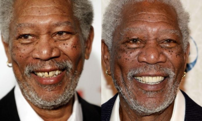 Morgan Freeman; 13 Famosos que le deben su hermosa sonrisa al dentista