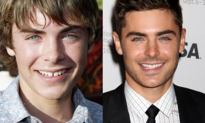 Zac Efron; 13 Famosos que le deben su hermosa sonrisa al dentista