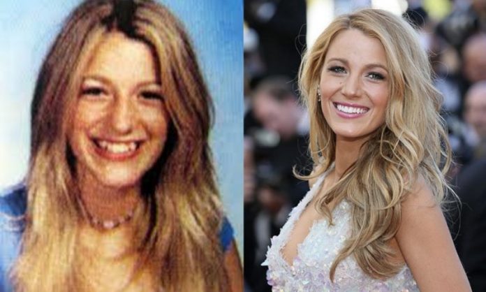 Blake Lively; 13 Famosos que le deben su hermosa sonrisa al dentista