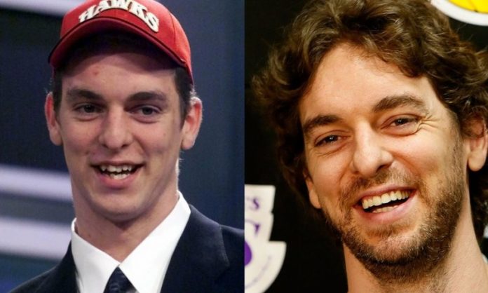 Pau Gasol; 13 Famosos que le deben su hermosa sonrisa al dentista