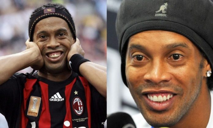 Ronaldinho; 13 Famosos que le deben su hermosa sonrisa al dentista