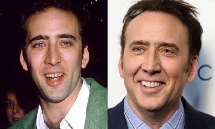 Nicolas Cage; 13 Famosos que le deben su hermosa sonrisa al dentista